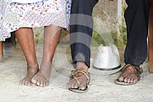 Worn feet - mexico