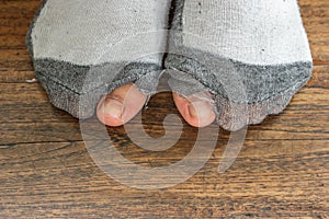 Worn out socks with a hole and toes.