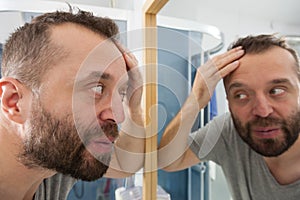 Worried man looking at his decreasing hairline photo
