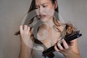 A worried woman suffering from hairloss