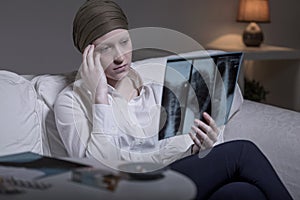 Worried woman and xray