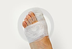 Wounded foot with bandages photo