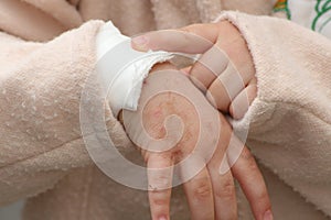 Wounded hand photo