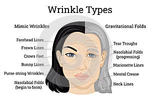 Wrinkle Types Illustration