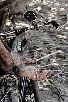 Wrinkled and dirty foot Of older people