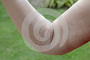 Wrinkled on elderly woman skin photo