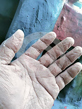 Wrinkled Hands Exposed to Water for Too Long photo