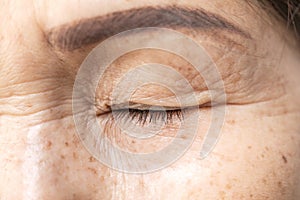 Wrinkled of old asian woman skin eyelid photo