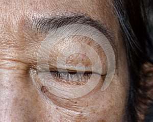 Wrinkles around closed eye of Asian elder woman photo