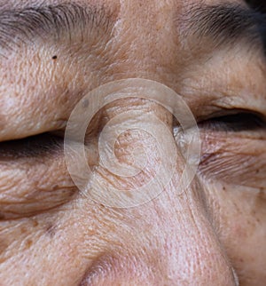 Wrinkles at the face of Asian elder woman photo