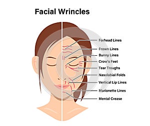 Wrinkles face and wrinkle-free face ( female face ) vector illustration