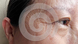 The wrinkles and flabby skin, cellulite and dark spots under the eyes.