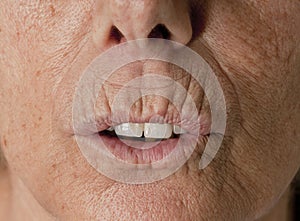 Wrinkle Lips Senior Wrinkles