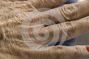 Wrinkly Hands