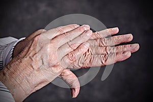 Wrinkly hands of elderly woman photo
