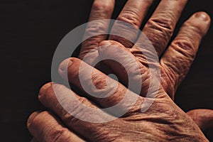 Wrinkly Hands of Old Man Close Up