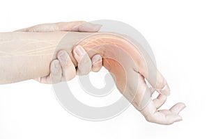 Wrist nerve injury