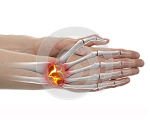 Wrist Pain - Studio shot with 3D illustration isolated on white