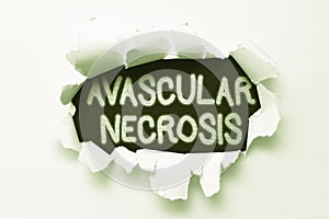 Writing displaying text Avascular Necrosis. Business overview death of bone tissue due to a lack of blood supply Tear on