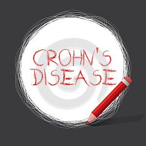 Writing note showing Crohn s is Disease. Business photo showcasing inflammatory disease of the gastrointestinal tract