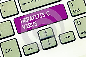 Writing note showing Hepatitis C Virus. Business photo showcasing Infective agent that causes viral hepatitis disease