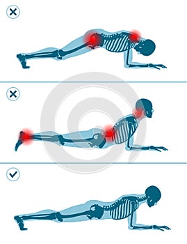 Wrong and correct plank position. Right and wrong execution technique of sport exercise. Common mistakes in sport