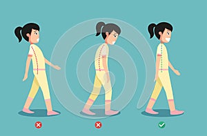 Wrong and correct walking posture