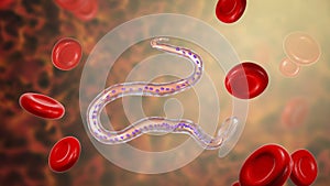 Wuchereria bancrofti, the causative agent of lymphatic filariasis