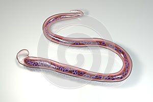 Wuchereria bancrofti, a roundworm nematode, one of the causative agents of lymphatic filariasis