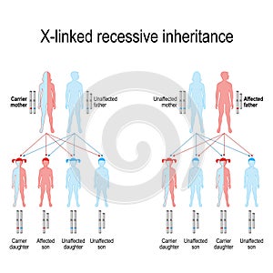 X-linked recessive inheritance