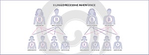 X linked recessive inheritance
