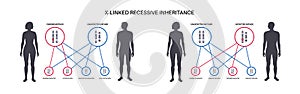 X linked recessive inheritance