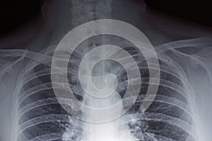 X-ray img