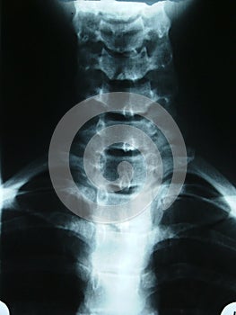 X-ray