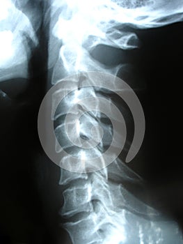 X-ray