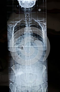 X-ray