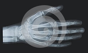 X-ray