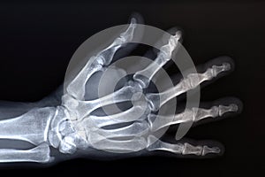 X-ray