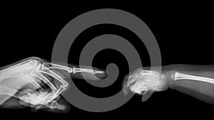 X-ray adult`s hand point finger at left side and baby`s hand at right side. Blank area at upper side