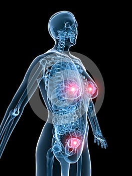 X-ray anantomy-highlighted uterus and breast