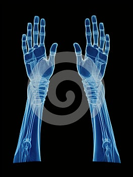 X-ray of arm of a male human, blue tone radiograph on a black background, Xray Orthopedic Medical, Ai generative