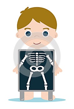 X ray bones kid