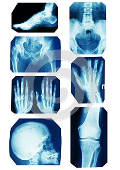 X-ray collection