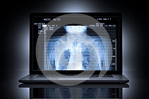 X-Ray CT Scan Computer Healthcare photo