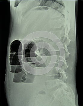 X-ray diagnostics photo