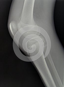 X-ray diagnostics/knee photo