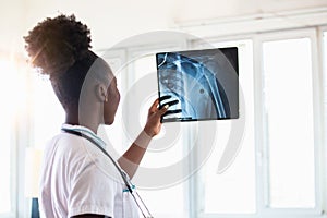 X-ray film image with doctor for medical and radiological diagnosis on female patientâ€™s health on disease and bone cancer