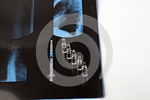 X-ray film thoracic spine with medical face mask. Concept of medical service, diagnosis and treatment. Syringe with pain