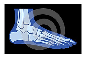 X-Ray Foot Legs Skeleton Human body Bones - malleolus, Phalanges adult people roentgen side view. Realistic flat blue photo