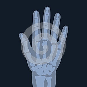 X-ray graphic image of the hand. Symptoms of a physical examination of the joints and bones of a person. .